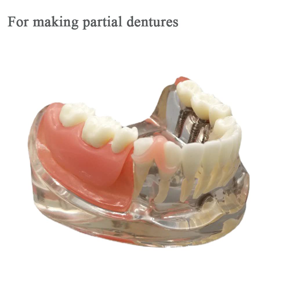 DIY Denture Tooth Repair Kit R51516